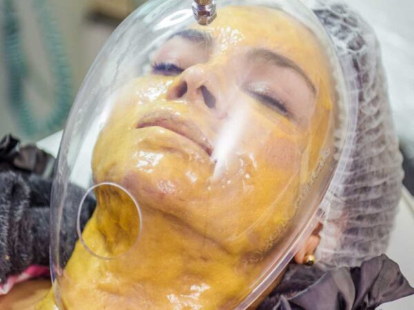 Imagen de oxigenoterapia facial en mujer