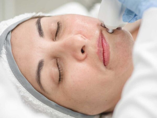 Imagen de tratamiento Venus Freeze facial en mujer.