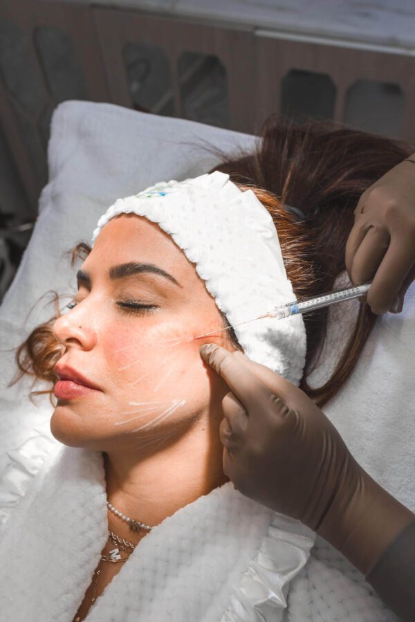 Mujer recibiendo bioestimuladores en el rostro