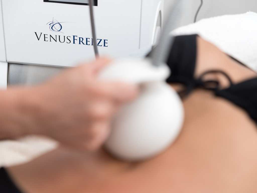 Tratamiento Venus Freeze para eliminar la flacidez en el abdomen