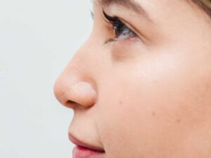 Perfect nose image, with rhinomodeling treatment