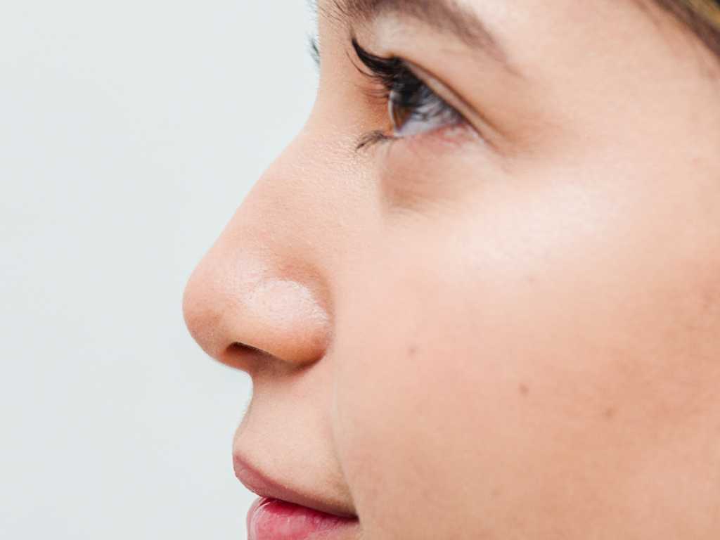 Perfect nose image, with rhinomodeling treatment
