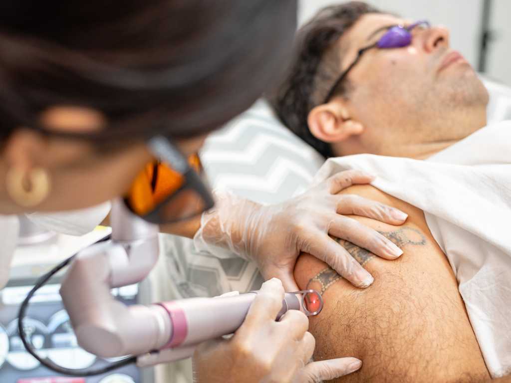 Imagen de un hombre en tratamiento láser para remover tatuajes