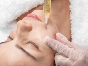 Imagen de tratamiento con plasma rico en plaquetas